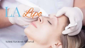 Woman receiving Actinic Keratosis Removal Treatment Uckfield