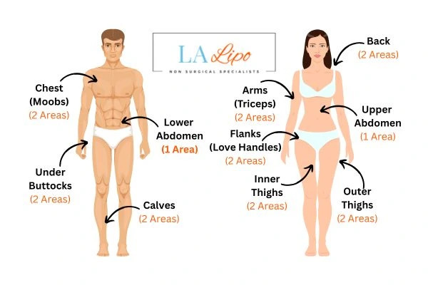 LA LIPO Cryolipolysis Areas Uckfield