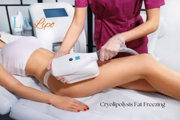 Woman receiving coolsculpting Uckfield treatment on her thighs