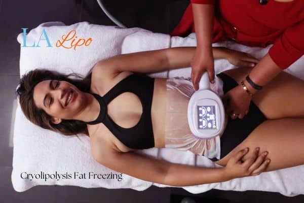 woman getting cryolipolysis Uckfield