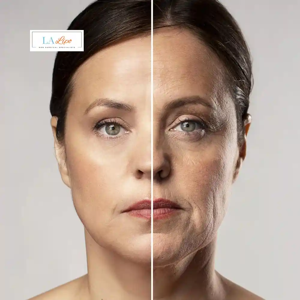 How Can You Tell If Non-Surgical Skin Tightening Is Right for You Uckfield?