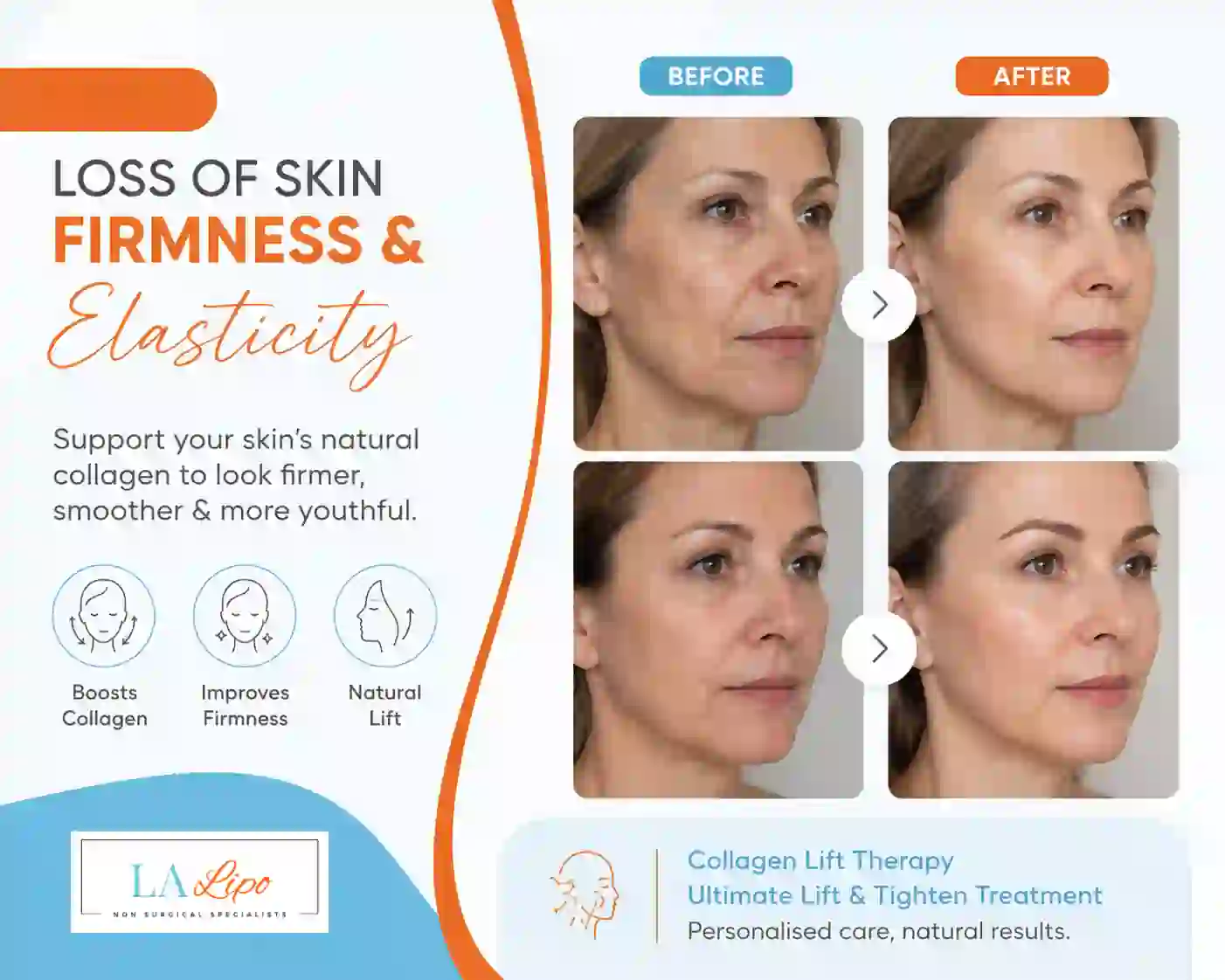 Sign #7: Loss of Skin Firmness and Elasticity Uckfield