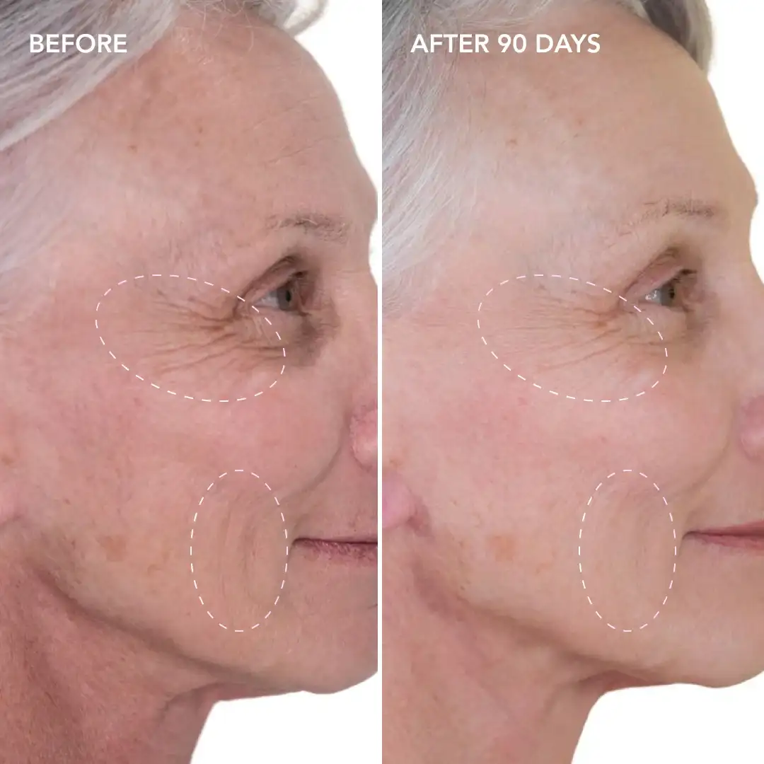 When will you see results Uckfield
